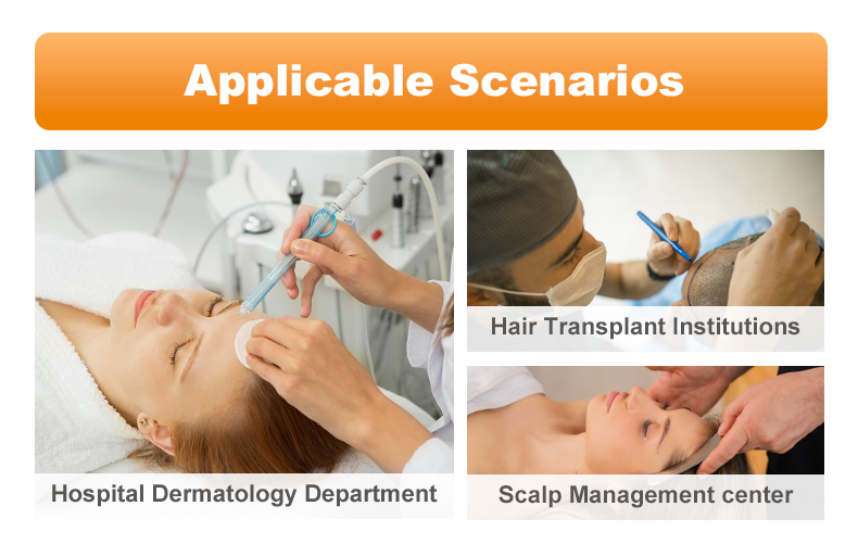 "scalp analysis machine applicable scenarios within hospital dermatology department,hair transplant institutions and scalp management center" 