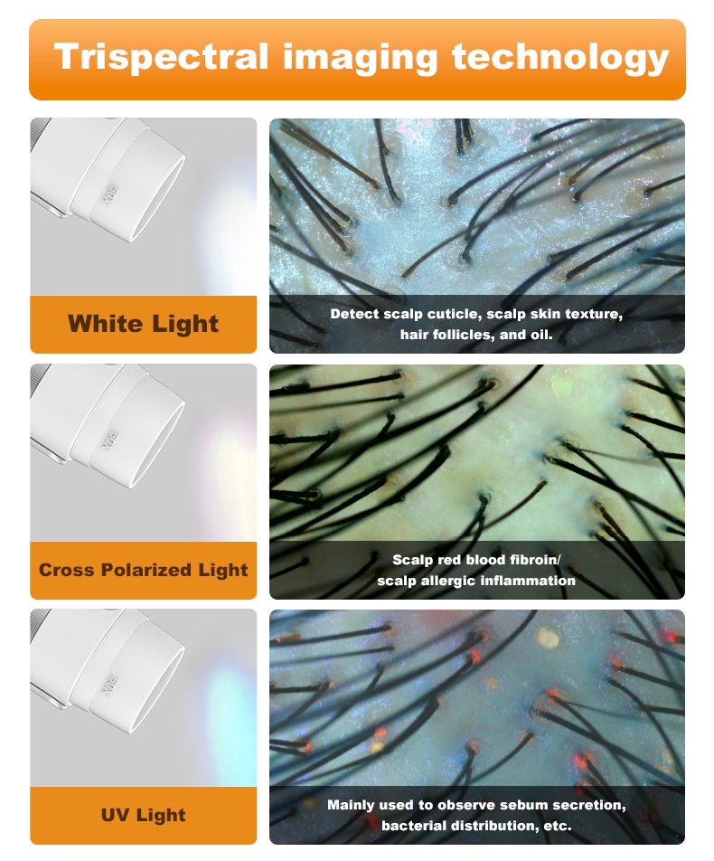 "scalp analysis machine with trispectral imaging technology, white light, cross polarized light and UV light"