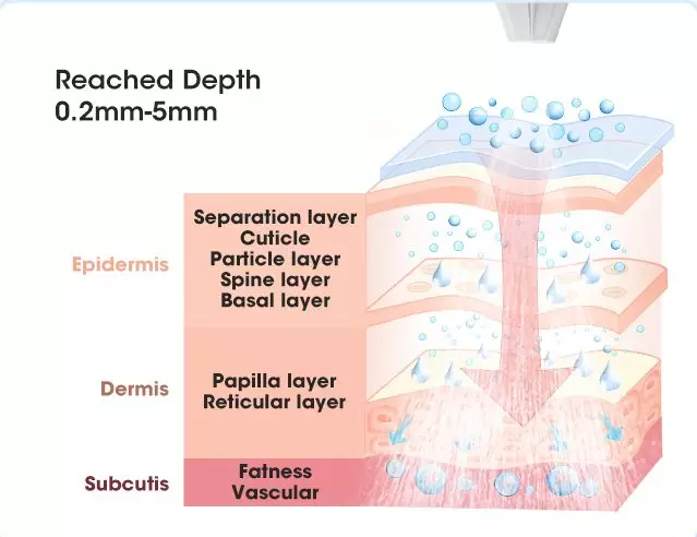 The needless mesogun can reach the skin depth 