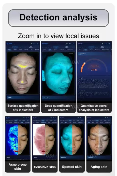 skin scanner