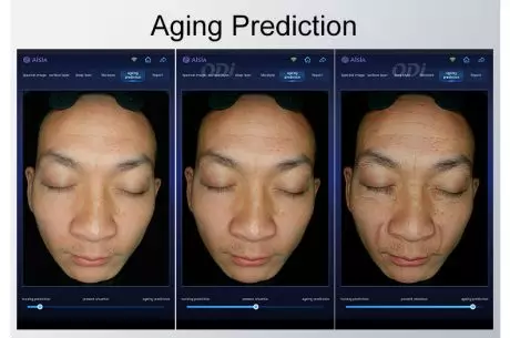 skin analysis skincope machine