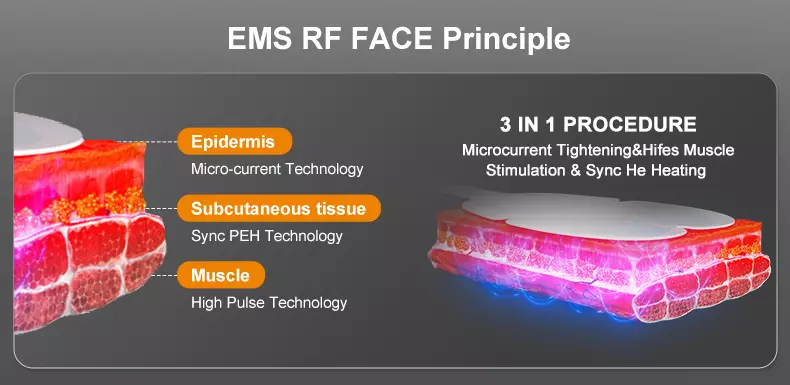 ems-machine- face-principle