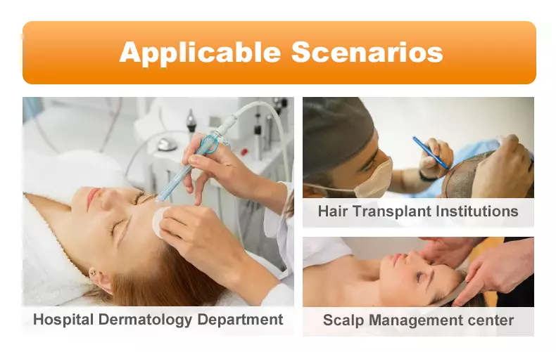 "scalp analysis machine applicable scenarios within hospital dermatology department,hair transplant institutions and scalp management center" 