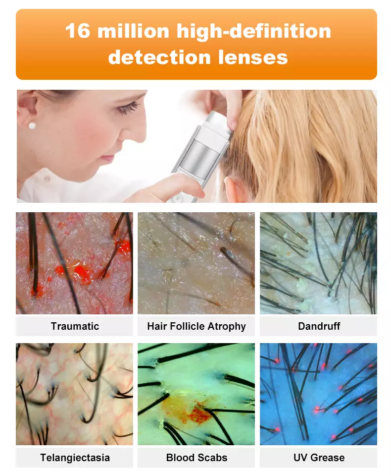 "16 million high-definition detection lenses"