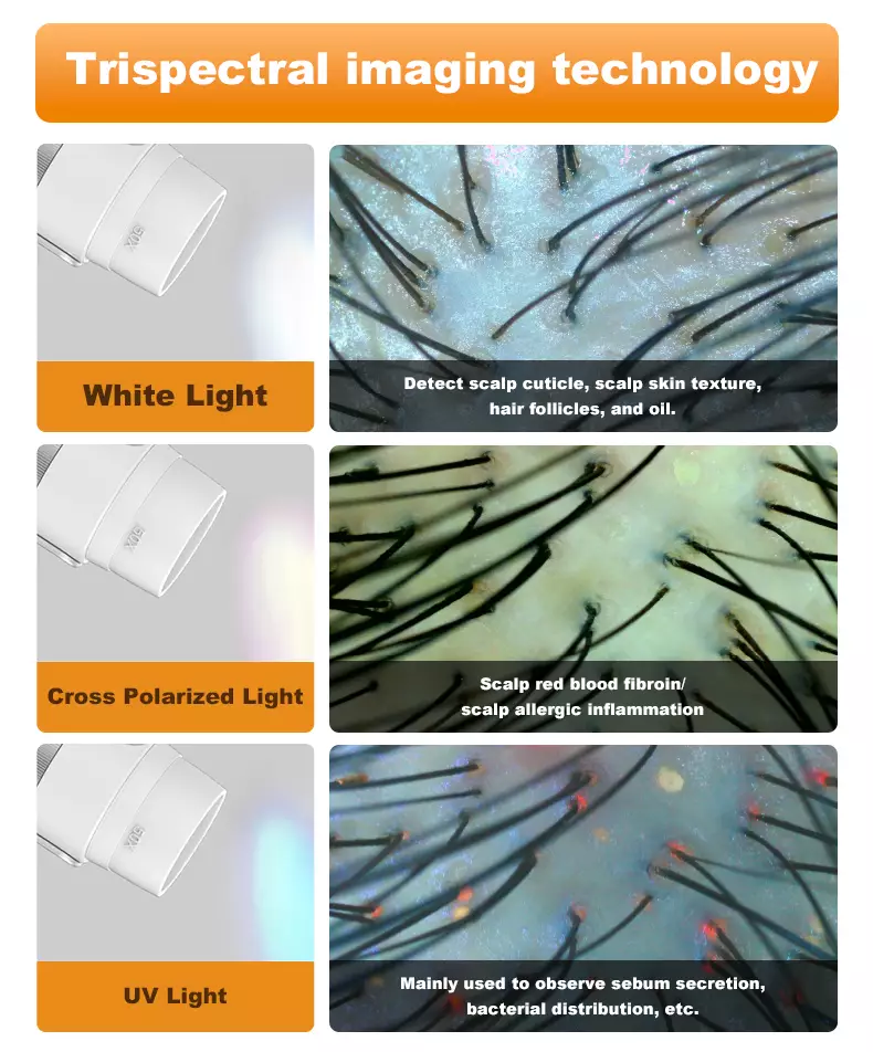 "scalp analysis machine with trispectral imaging technology, white light, cross polarized light and UV light"