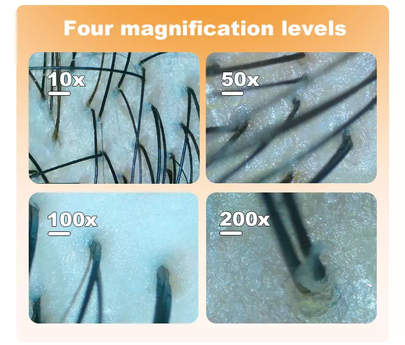 "four magnification levels"
