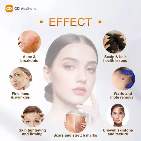 cold-plasma-machine-effect