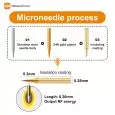 fractional-rf-microneedle-working-process