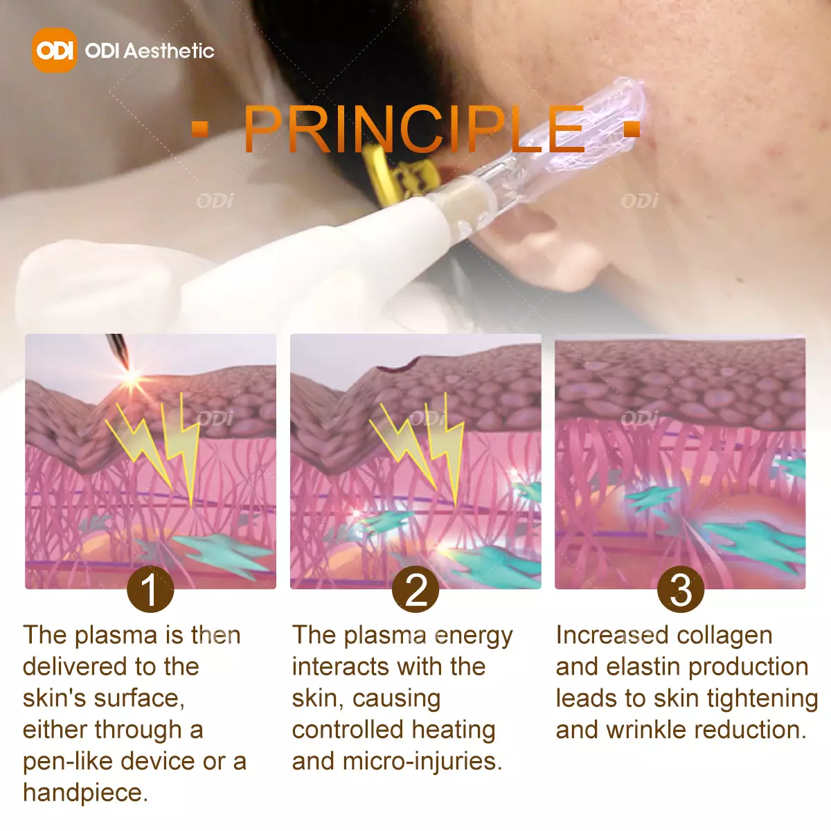 jet-plasma-treatment-principle