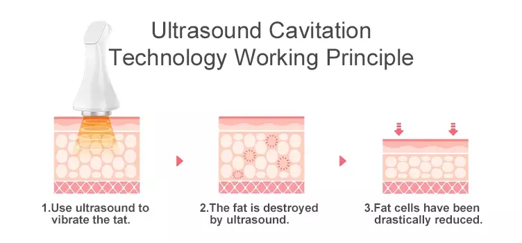 Ultrasound-Cavitation-Machine