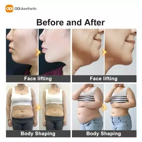 body-slimming-machine