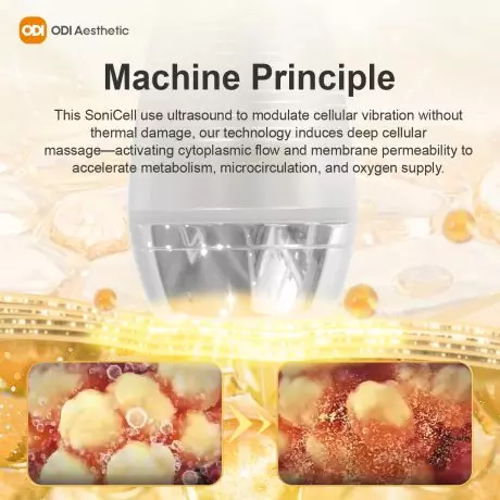 ultrasound-face-tightening-principle