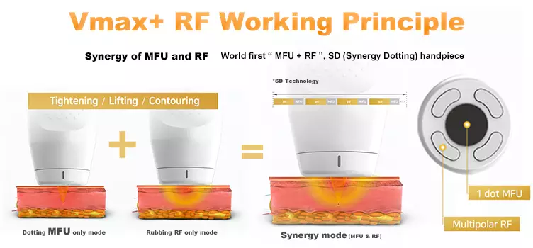 vmx-hifu-and rf-principle