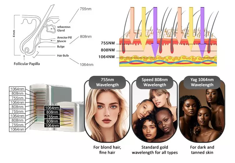 triple-wavelength-diode-laser-(755 808 1064)