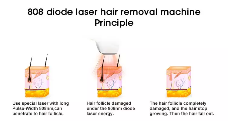 ice-dioden-laser-machine-principle