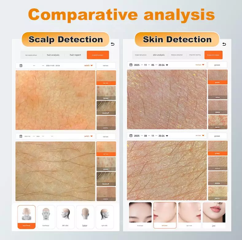 hair-analyser-machine (10)