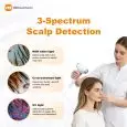 scalp-analysis-3-spectrum-scalp-detection