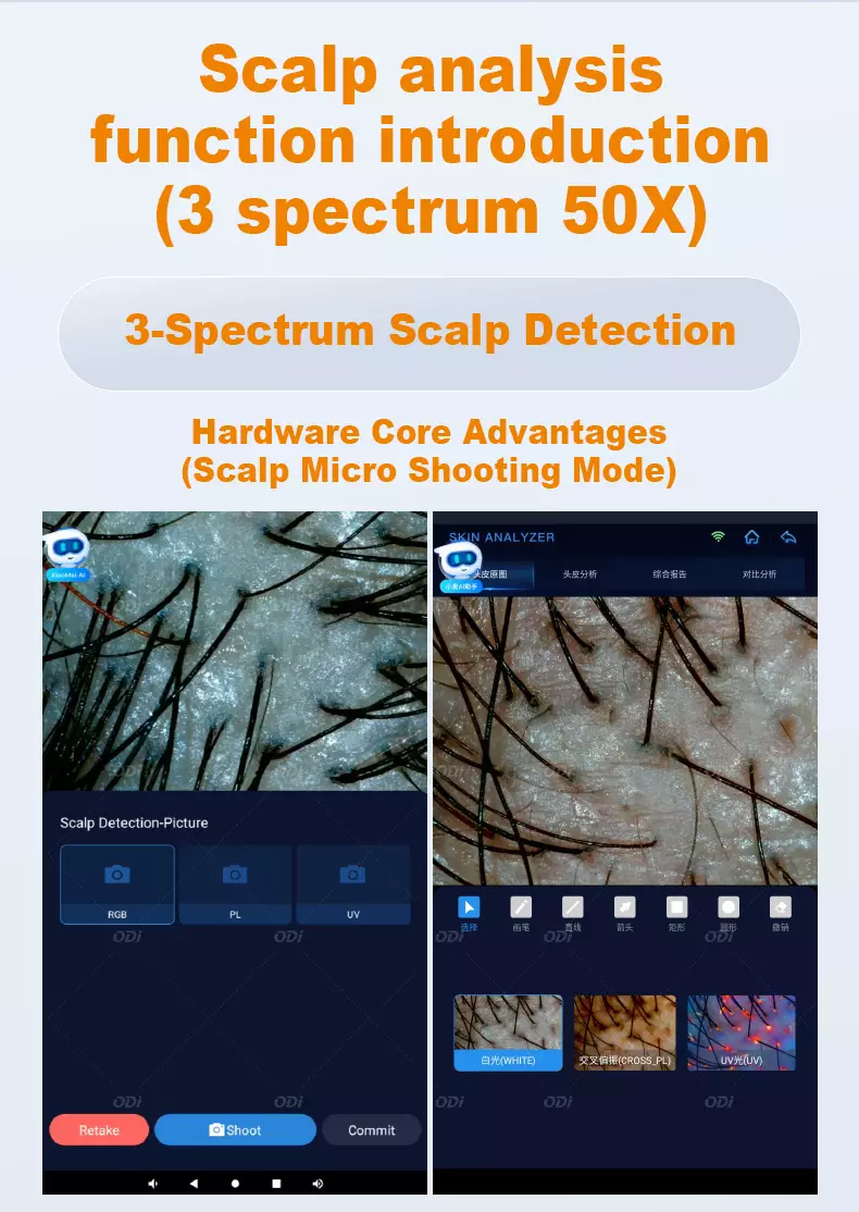 Scalp-analysis-function -introduction(3 spectrum 50X)