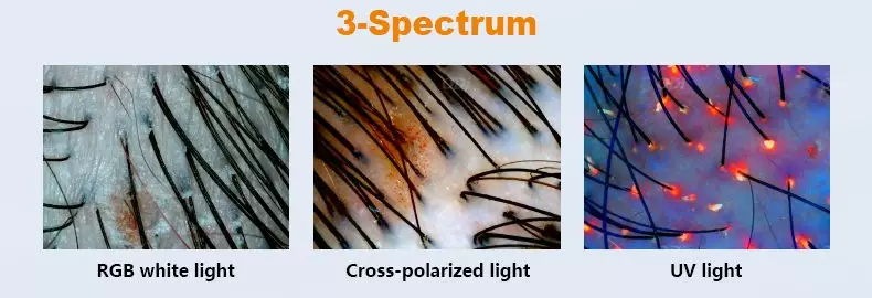 scalp-analysis-3-Spectrum