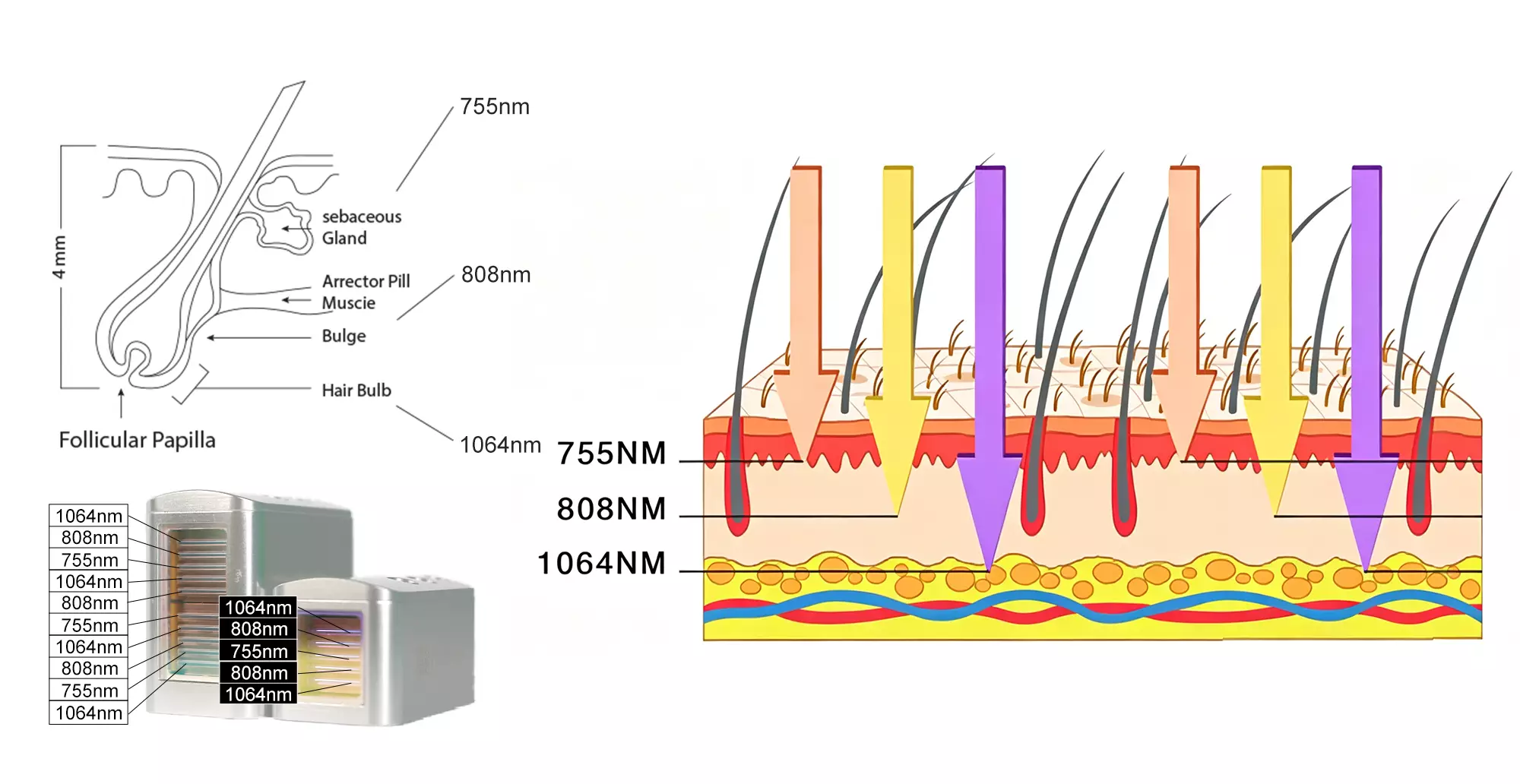 755-808-1064nm-laser