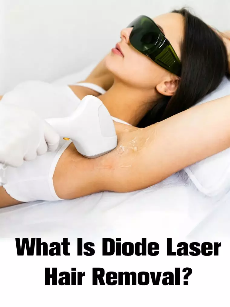 what-is-diode-laser-hair-removal