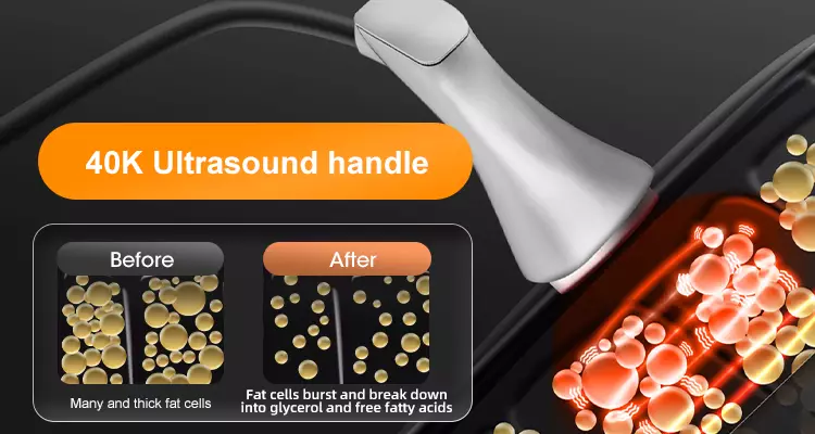 odi-40K cavitation-handle