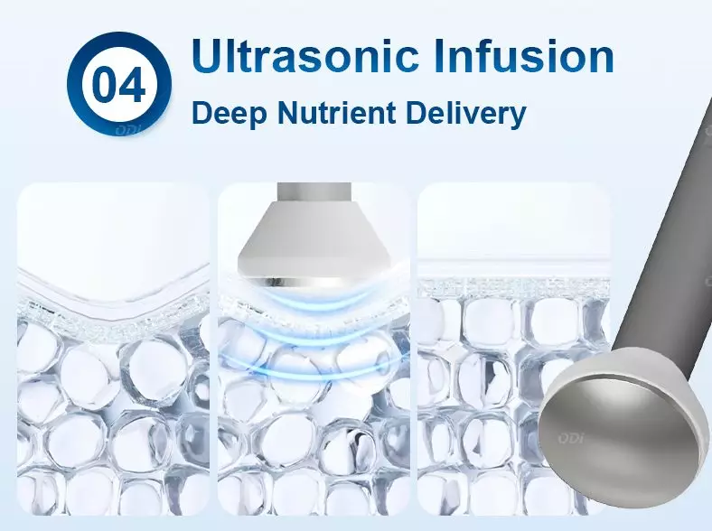 Ultrasonic-infusion-tip