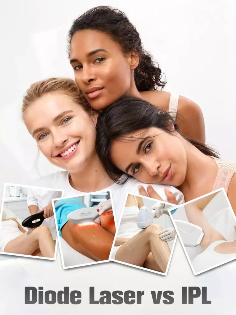 diode-laser-vs-ipl