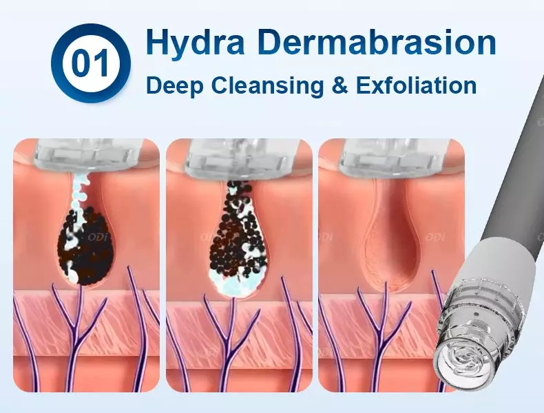 professional-hydrodermabrasion-machine