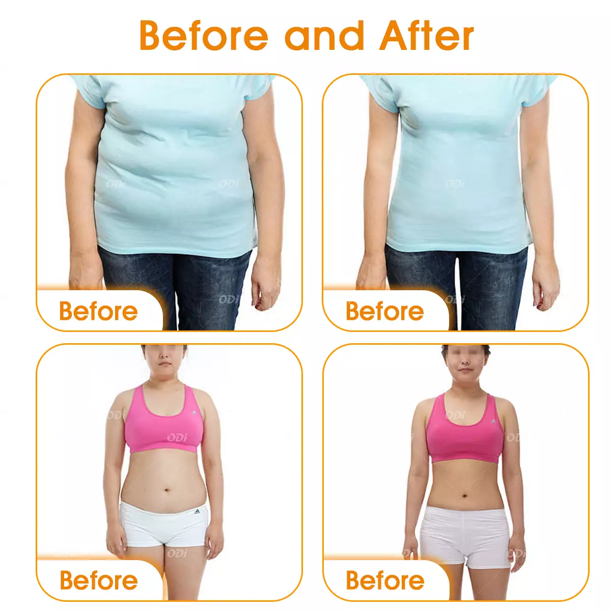 velashape-slimming-machine-before-and after