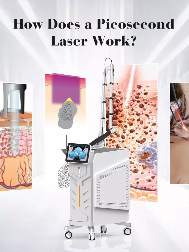 how-does-a-picosecond-laser-work