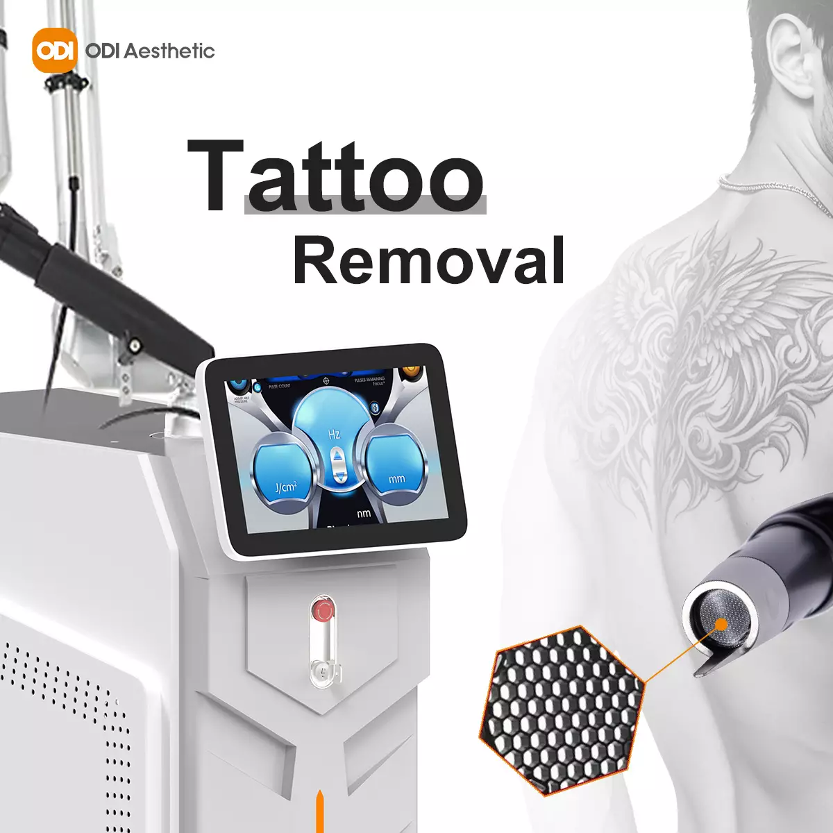 tattoo-removal-machine-price
