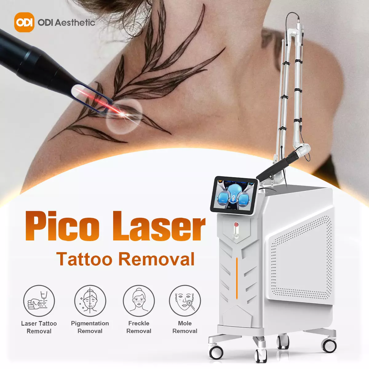 pico-laser-tattoo-removal